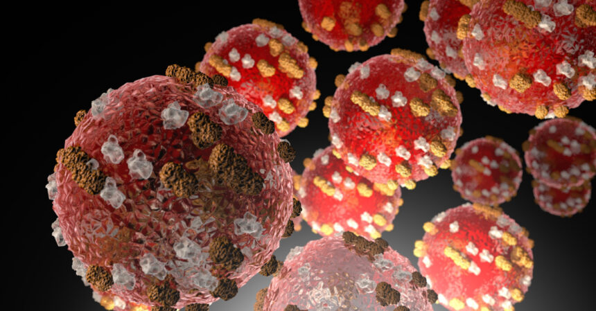 measles alert